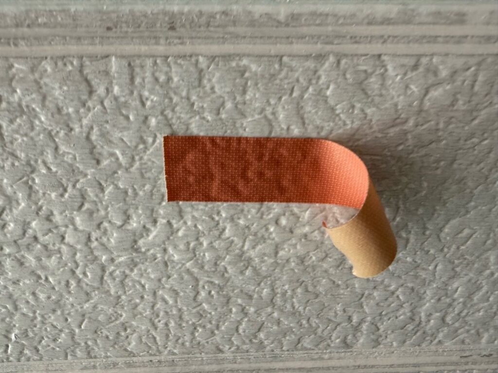 パッチテスト　剥離テープ貼り